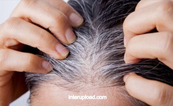 wellhealthorganic.com/know the causes of white hair and easy ways to prevent it naturally