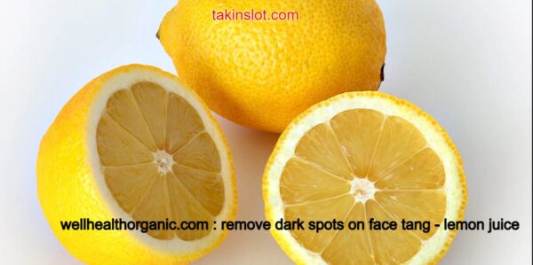 wellhealthorganic.com : remove dark spots on face tang – lemon juice